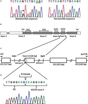 Hypoparathyroidism, deafness and renal dysplasia syndrome caused by a GATA3 splice site mutation leading to the activation of a cryptic splice site